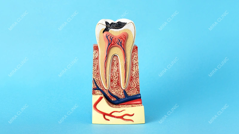 Damaged Tooth